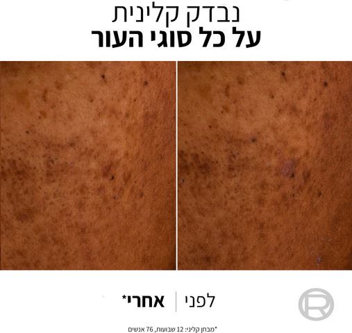 לוריאל ברייט ריביל תחליב לחות והגנה L'Oreal SPF50