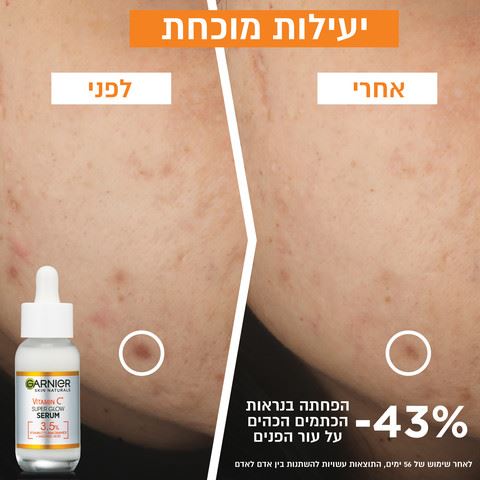 גרנייה סרום לפנים ויטמין Garnier Skin Active C